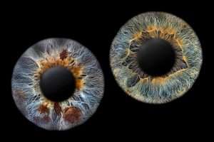 Irisfoto / Iris fotografie Paar